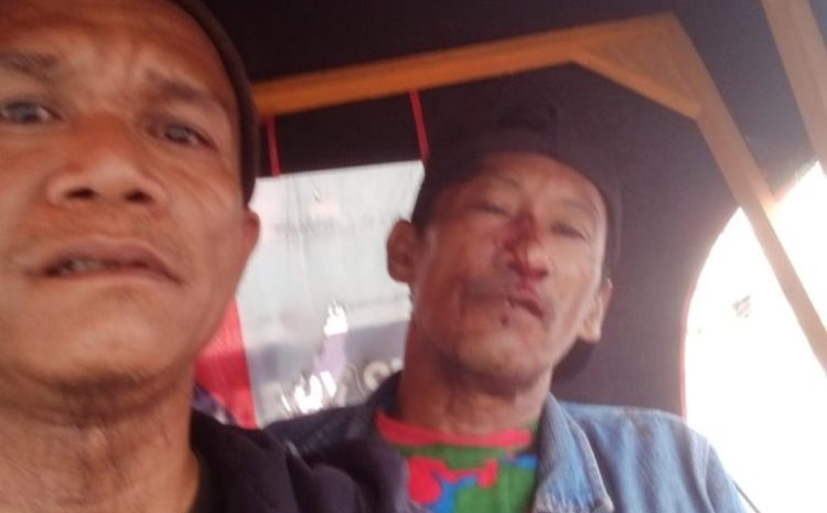  Sudah 7 Bulan Berlalu, Laporan Korban Penganiayaan di Polrestabes Medan Belum Ada Tindak Lanjut
