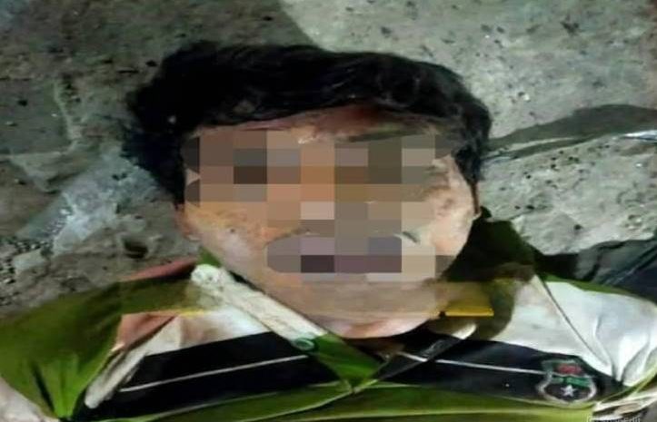  Berkelahi Dengan Korban, Terduga Perampok di Sei Mati Medan Labuhan Tewas 