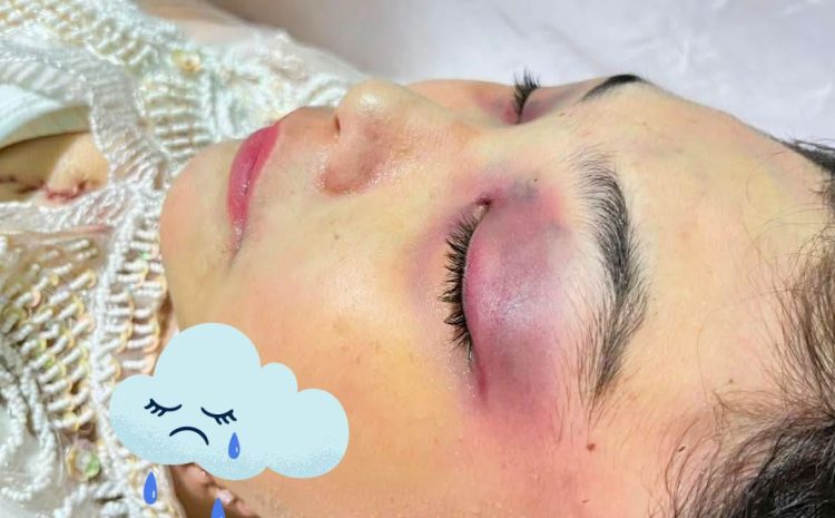  LBH Medan Menduga Kematian Wina Lorenza Gowasa Bukan Bunuh Diri, Melainkan Adanya Dugaan Tindak Pidana